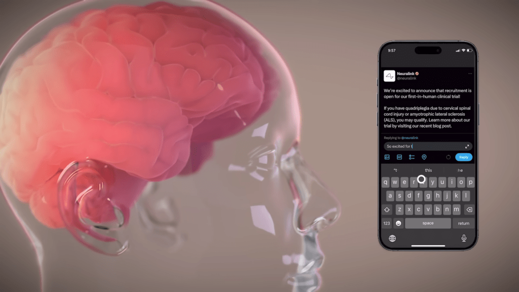 Neuralink